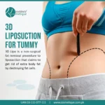 liposuction treatment in Lahore