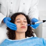 Microneedling Toronto