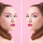 Rhinoplasty Before and After